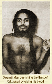 Shivabalayogi, his hand showing the bites of Raktha Kali